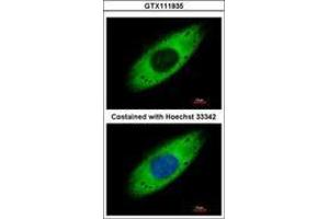 Image no. 4 for anti-Ribosomal Protein S3A (RPS3A) (AA 1-264) antibody (ABIN1501993)