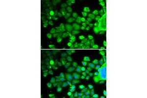 Immunofluorescence analysis of MCF-7 cells using RPS10 antibody (ABIN1877083). (RPS10 Antikörper)