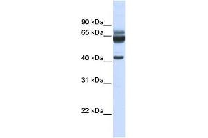 PARD6B antibody used at 1 ug/ml to detect target protein. (PARD6B Antikörper)