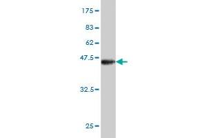 Western Blot detection against Immunogen (40. (BRD3 Antikörper  (AA 418-556))