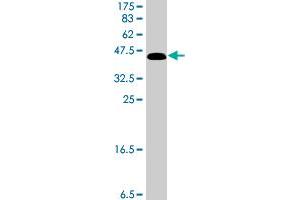 Western Blot detection against Immunogen (42. (RPS14 Antikörper  (AA 1-151))