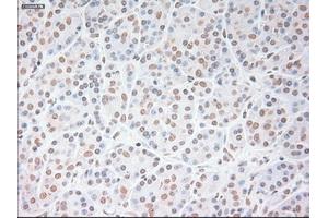 Immunohistochemical staining of paraffin-embedded lung tissue using anti-USP13mouse monoclonal antibody. (USP13 Antikörper)