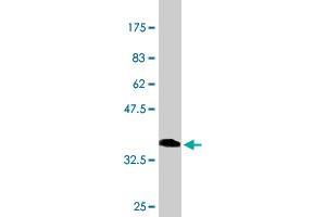 Western Blotting (WB) image for anti-Cut-Like Homeobox 1 (CUX1) (AA 521-620) antibody (ABIN560539)