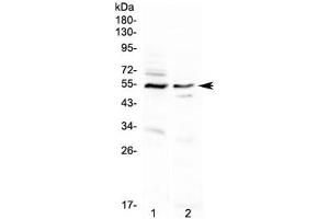 Western blot testing of human 1) A431 and 2) PANC-1 cell lysate with VIPR1 antibody.