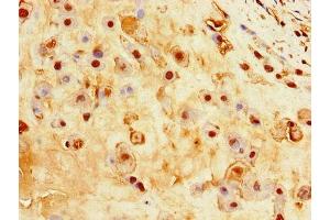 Immunohistochemistry of paraffin-embedded human placenta tissue using ABIN7156880 at dilution of 1:100 (EBI3 Antikörper  (AA 21-227))