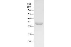 Western Blotting (WB) image for Lectin, Galactoside-Binding, Soluble, 8 (LGALS8) (AA 1-317) protein (His-IF2DI Tag) (ABIN7123734)