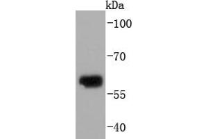 Human skin ysates probed with Collagen X (1H8) Monoclonal Antibody  at 1:1000 overnight at 4˚C. (COL10 Antikörper)