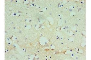Immunohistochemistry of paraffin-embedded human brain tissue using ABIN7170476 at dilution of 1:100 (SPAG16 Antikörper  (AA 1-183))