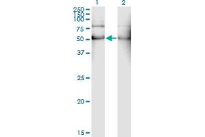 Western Blot analysis of ALDH2 expression in transfected 293T cell line by ALDH2 monoclonal antibody (M01), clone 1E5.