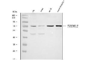 anti-Triggering Receptor Expressed On Myeloid Cells-Like 2 (TREML2) (AA 64-321) antibody