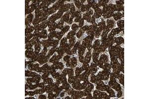 Immunohistochemical staining of human liver with FLII polyclonal antibody  shows strong cytoplasmic positivity in hepatocytes at 1:50-1:200 dilution. (FLII Antikörper)