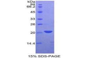 SDS-PAGE (SDS) image for Leukocyte Cell-Derived Chemotaxin 2 (LECT2) (AA 1-151) protein (His tag) (ABIN2125651)