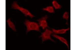 ABIN6276083 staining Hela by IF/ICC. (PSGR Antikörper  (Internal Region))