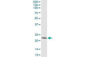 YKT6 monoclonal antibody (M03), clone 1F8. (YKT6 Antikörper  (AA 99-198))