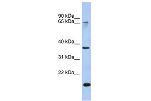 WB Suggested Anti-ANXA10 Antibody Titration:  0.