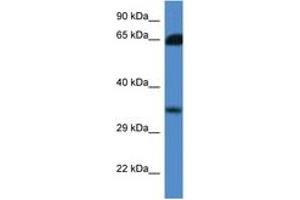 Image no. 1 for anti-Methylthioribose-1-Phosphate Isomerase 1 (Mri1) (AA 100-149) antibody (ABIN6746835) (MRI1 Antikörper  (AA 100-149))