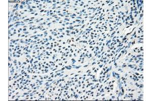 Immunohistochemical staining of paraffin-embedded endometrium tissue using anti-SLC2A5mouse monoclonal antibody. (SLC2A5 Antikörper)