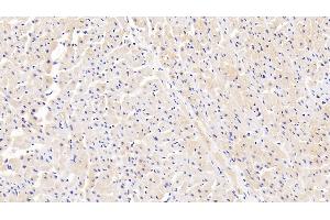 Detection of IRAK4 in Human Cardiac Muscle Tissue using Polyclonal Antibody to Interleukin 1 Receptor Associated Kinase 4 (IRAK4) (IRAK4 Antikörper  (AA 189-427))