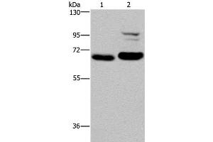 Western Blot analysis of K562 and NIH/3T3 cell using OS9 Polyclonal Antibody at dilution of 1:200 (OS9 Antikörper)