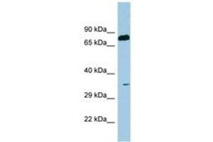 Image no. 1 for anti-serine Dehydratase (SDS) (AA 71-120) antibody (ABIN6741650) (serine Dehydratase Antikörper  (AA 71-120))