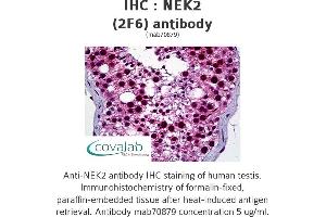 Image no. 1 for anti-NIMA (Never in Mitosis Gene A)-Related Kinase 2 (NEK2) (AA 331-445) antibody (ABIN1723728) (NEK2 Antikörper  (AA 331-445))