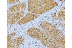 IHC analysis of YY1 using anti-YY1 antibody (ABIN7603000).