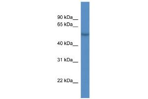 WB Suggested Anti-CDR2L Antibody Titration:  0.