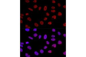 Confocal immunofluorescence analysis of U2OS cells using BC Polyclonal Antibody (ABIN6127480, ABIN6137479, ABIN6137480 and ABIN6220613) at dilution of 1:100. (BCAS2 Antikörper  (AA 1-225))