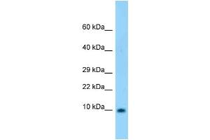 WB Suggested Anti-S100b Antibody Titration: 1. (S100B Antikörper  (N-Term))