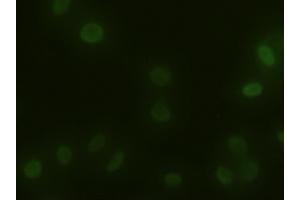 Immunofluorescent staining of HeLa cells using anti-ACTN1 mouse monoclonal antibody (ABIN2452359).
