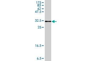 Western Blot detection against Immunogen (33. (AKR1B10 Antikörper  (AA 76-143))