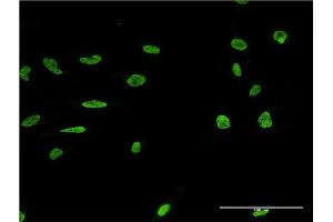 Immunofluorescence of monoclonal antibody to MARK2 on HeLa cell. (MARK2 Antikörper  (AA 401-500))