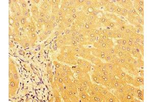 Immunohistochemistry of paraffin-embedded human liver tissue using ABIN7164477 at dilution of 1:100 (GPR179 Antikörper  (AA 1440-1671))