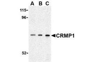 Western blot analysis of CRMP1 in 3T3 cell lysate with AP30242PU-N CRMP1 antibody at (A) 0. (CRMP1 Antikörper  (C-Term))