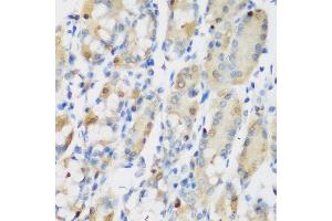Immunohistochemistry of paraffin-embedded human gastric using RRM1 antibody at dilution of 1:200 (40x lens). (RRM1 Antikörper)
