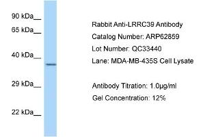 Western Blotting (WB) image for anti-Leucine Rich Repeat Containing 39 (LRRC39) (C-Term) antibody (ABIN2789270) (LRRC39 Antikörper  (C-Term))