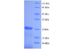 Suppressor of Cytokine Signaling 1 (SOCS1) (AA 1-211), (full length) protein (His tag)
