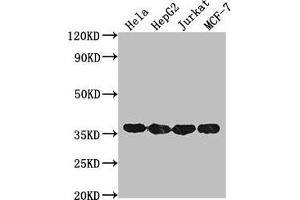 Western Blot Positive WB detected in: Hela whole cell lysate, HepG2 whole cell lysate, Jurkat whole cell lysate, MCF-7 whole cell lysate All lanes: GAPDH antibody at 1:2000 Secondary Goat polyclonal to mouse IgG at 1/50000 dilution Predicted band size: 36 KDa Observed band size: 36 KDa Exposure time: 30s (GAPDH Antikörper  (AA 3-335))