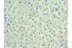 Immunohistochemistry of paraffin-embedded human liver tissue using ABIN7168307 at dilution of 1:100 (UPF0568 Protein C14orf166 (RTRAF) (AA 1-244) Antikörper)