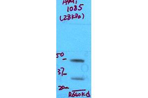 Aquaporin 1 Western Blot. (Aquaporin 1 Antikörper  (N-Term))