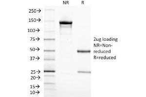 SDS-PAGE Analysis Purified CD3 epsilon Monoclonal Antibody (C3e/1308). (CD3 epsilon Antikörper  (AA 23-119))