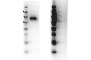 Western Blot of Rabbit anti-RON antibody. (MST1R Antikörper  (Internal Region, Tyr1360))