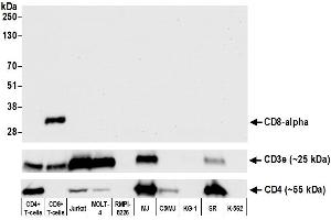 Western Blotting (WB) image for anti-CD8a Molecule (CD8A) (AA 185-235) antibody (ABIN7449561)