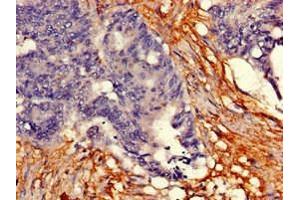 Immunohistochemistry (IHC) image for anti-Tryptophan Hydroxylase 2 (TPH2) (AA 44-225) antibody (ABIN7173617)