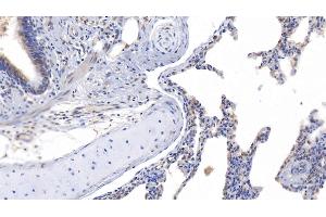 Detection of 0 in Human Lung Tissue using Polyclonal Antibody to Asprosin (Asprosin (AA 2732-2871) Antikörper)