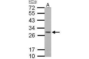 SDHB Antikörper  (C-Term)