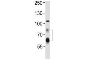 Western blot analysis of lysate from HeLa cell line using PCSK9 antibody.