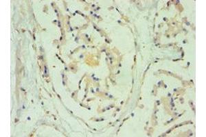 Immunohistochemistry of paraffin-embedded human prostate tissue using ABIN7170965 at dilution of 1:100 (SULT2B1 Antikörper  (AA 1-365))