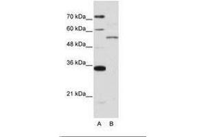 Image no. 1 for anti-Zinc Finger Protein 707 (ZNF707) (AA 26-75) antibody (ABIN6736219) (ZNF707 Antikörper  (AA 26-75))