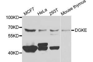 Western blot analysis of extracts of various cells, using DGKE antibody.